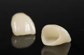 All Ceramic Crowns