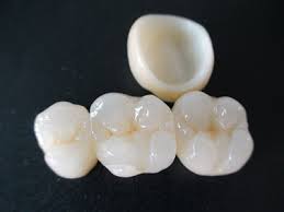 Zirconia Crowns